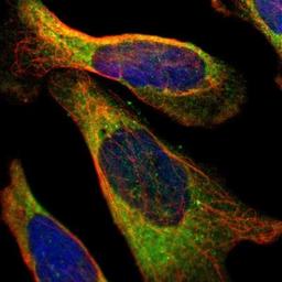 Immunocytochemistry/Immunofluorescence: Muscle Phosphofructokinase/PFKM/PFK-1 Antibody [NBP1-87293] - Staining of human cell line U-2 OS shows positivity in endoplasmic reticulum.