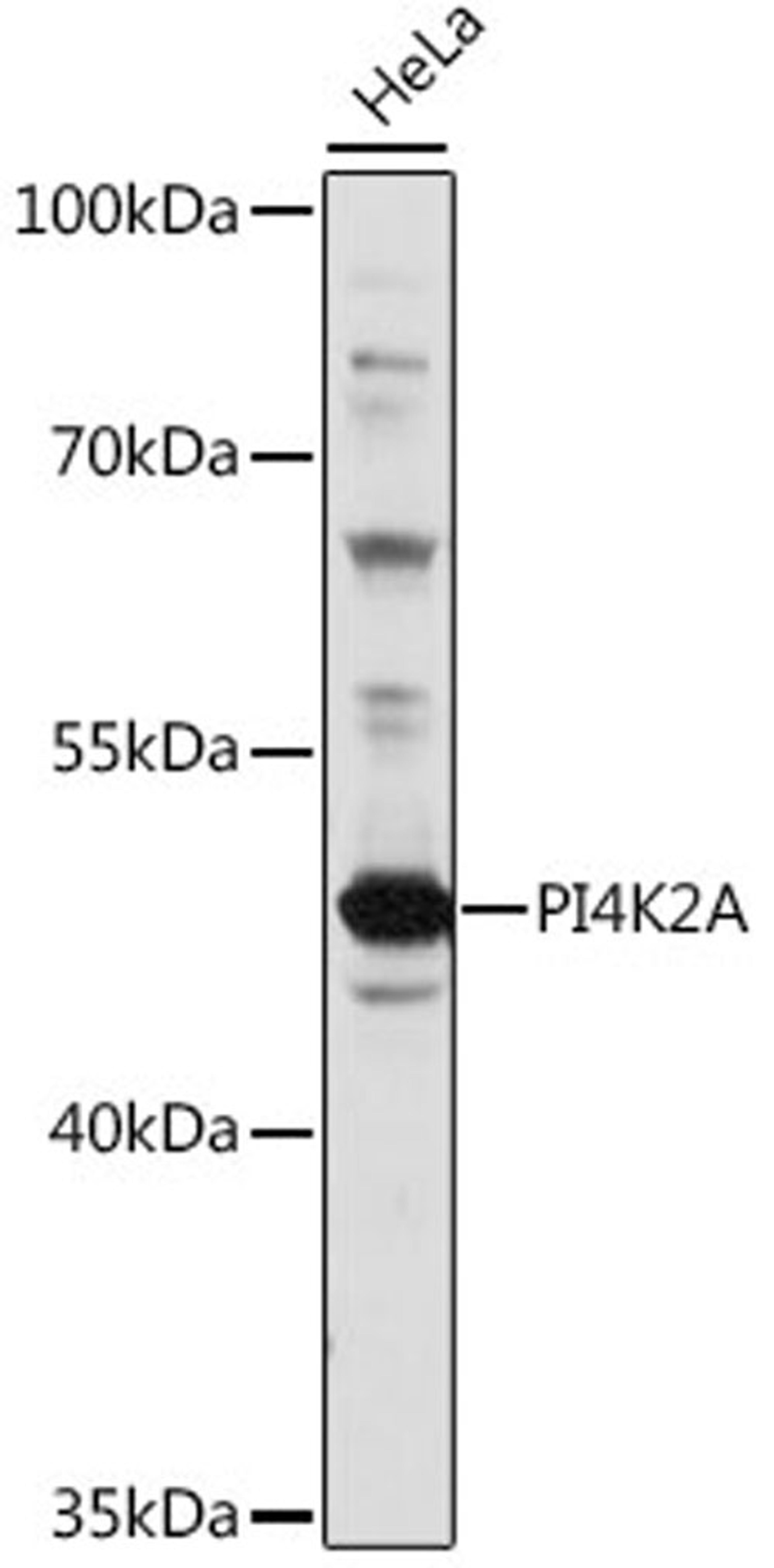 Western blot - PI4K2A antibody (A16546)