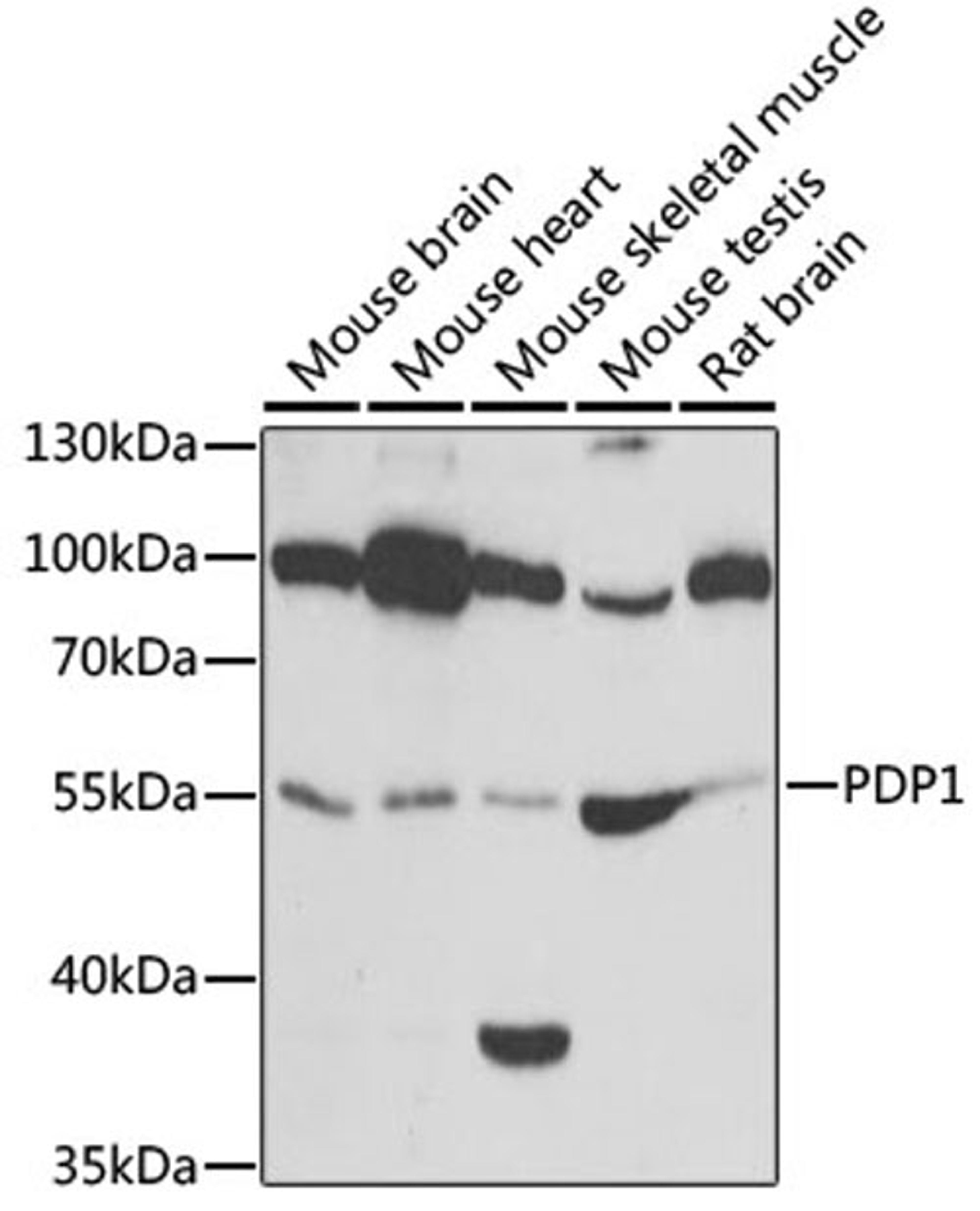 Western blot - PDP1 antibody (A6332)