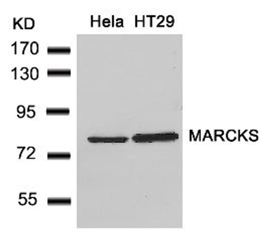 Western blot analysis of lysed extracts from HeLa and HT29 cells using MARCKS (Ab-162).