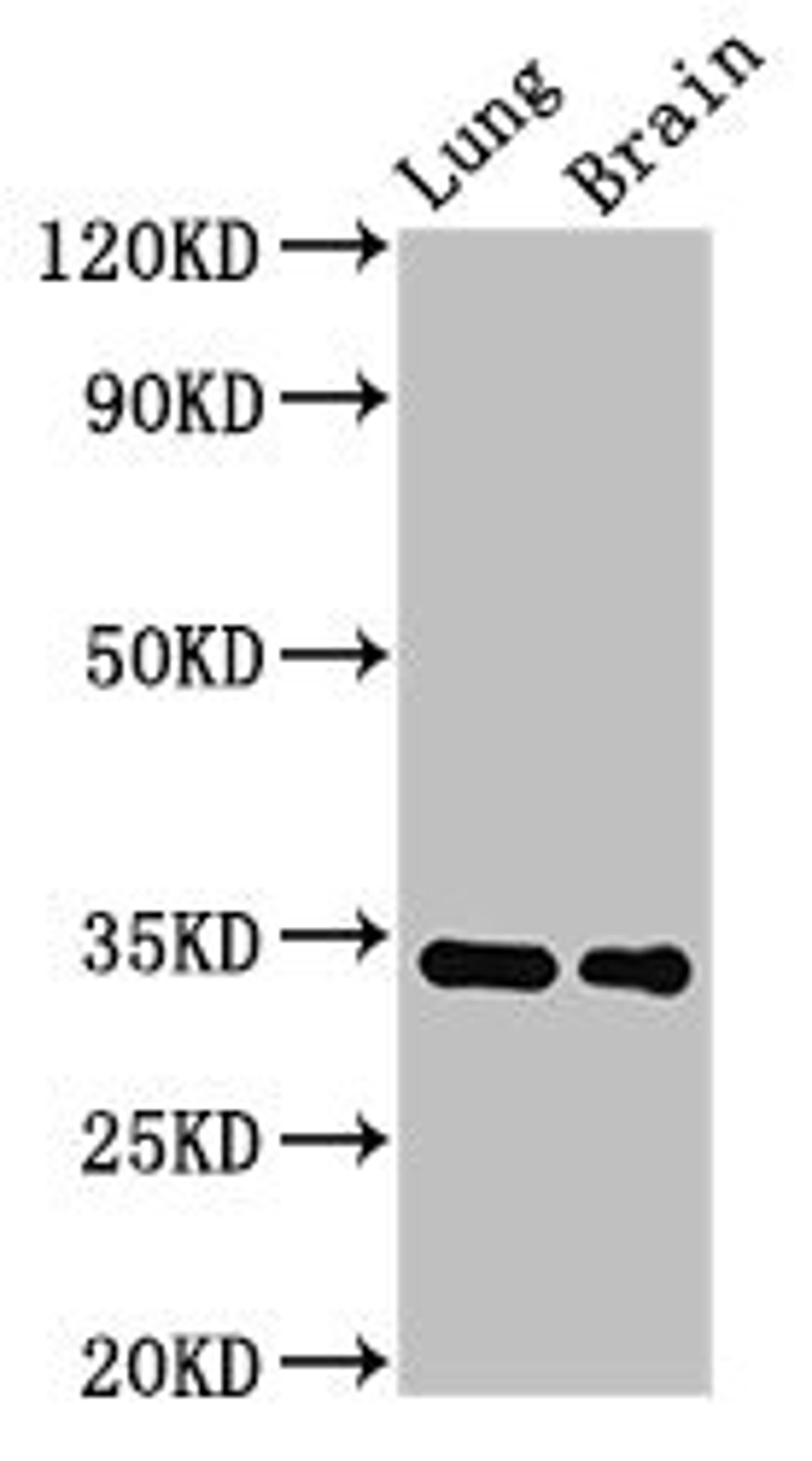 Western Blot. Positive WB detected in: Rat lung tissue, Mouse brain tissue. All lanes: Mgll antibody at 2.8µg/ml. Secondary. Goat polyclonal to rabbit IgG at 1/50000 dilution. Predicted band size: 34 kDa. Observed band size: 34 kDa
