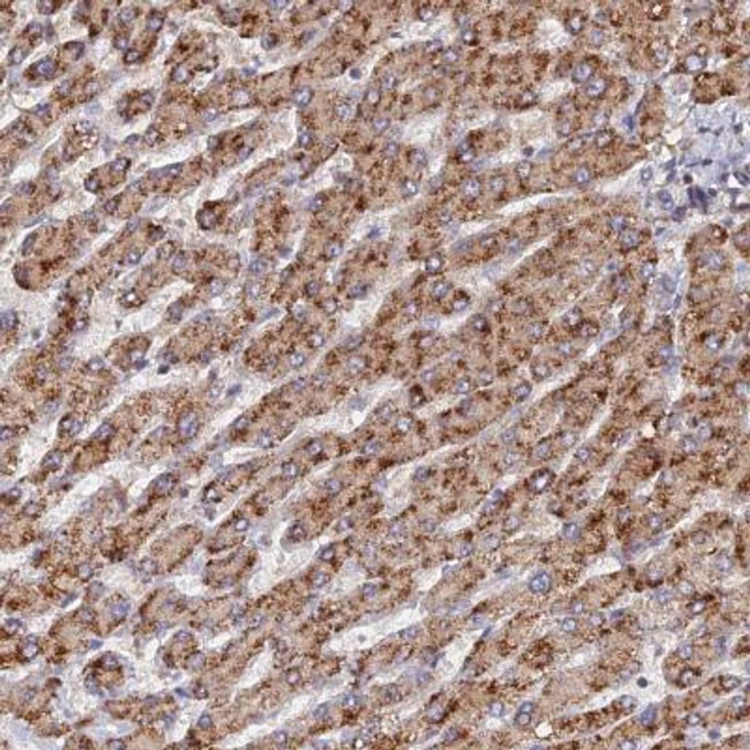 Immunohistochemistry: CCZ1 Antibody [NBP2-46711] - Analysis of human liver shows strong cytoplasmic positivity in hepatocytes.