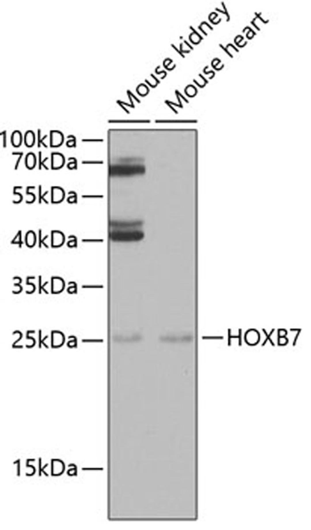 Western blot - HOXB7 antibody (A6925)