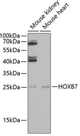 Western blot - HOXB7 antibody (A6925)