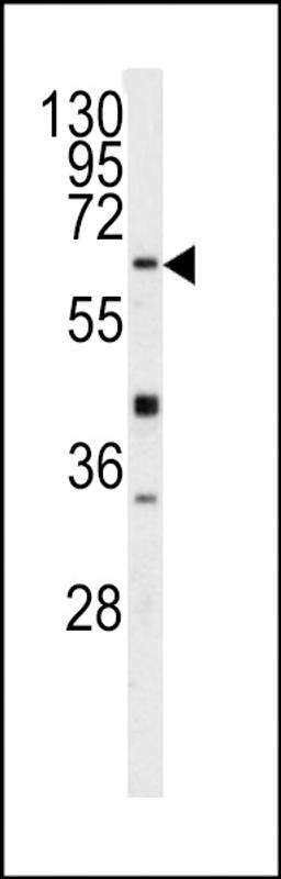 Western blot analysis of GGTLA1 antibody in Y79 cell line lysates (35ug/lane)