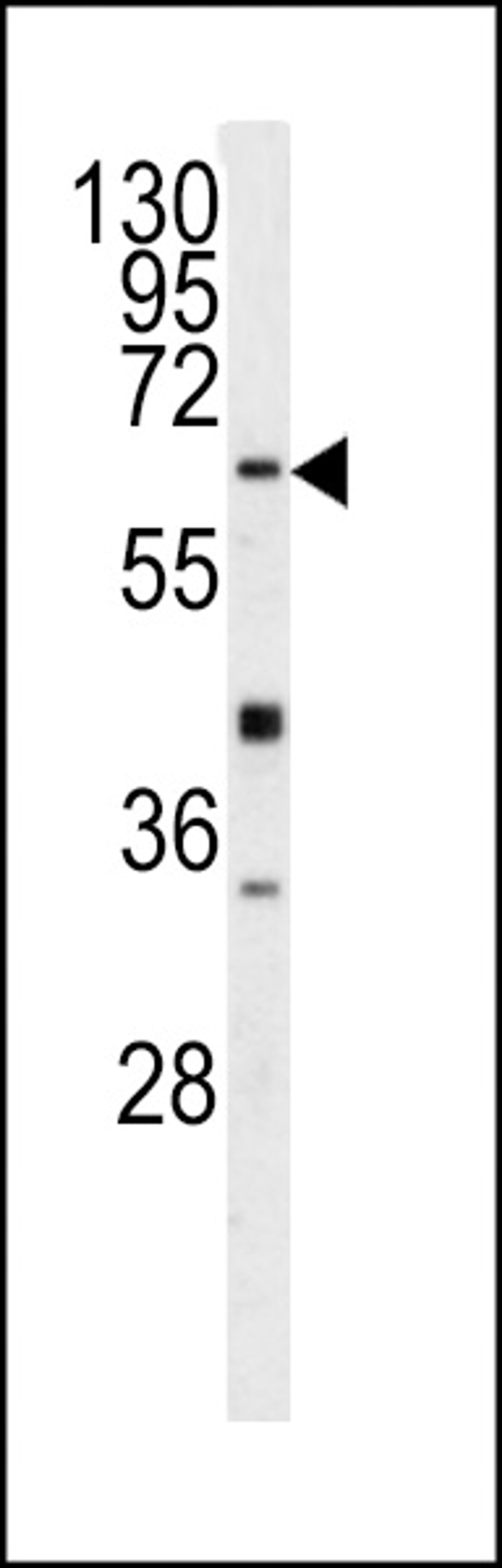 Western blot analysis of GGTLA1 antibody in Y79 cell line lysates (35ug/lane)