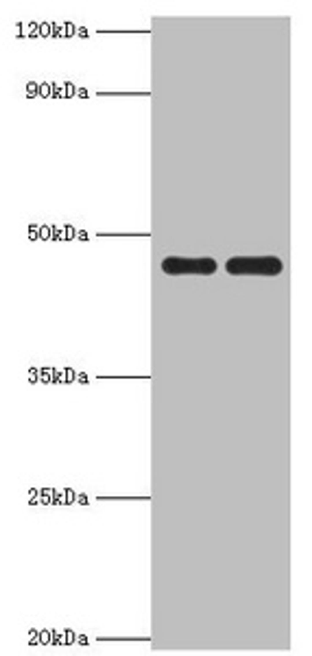 Western blot. All lanes: Paired box protein Pax-6 antibody at 1ug/ml. Lane 1: Mouse stomach tissue. Lane 2: Mouse eye tissue. Secondary. Goat polyclonal to rabbit IgG at 1/10000 dilution. Predicted band size: 47, 49 kDa. Observed band size: 47 kDa.