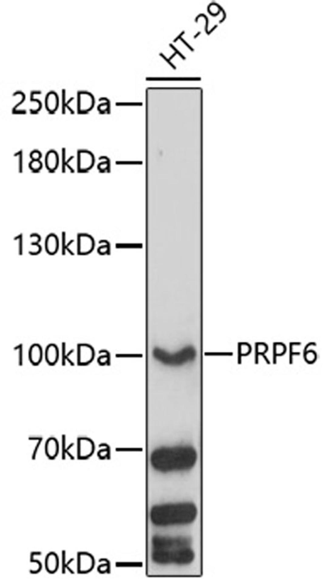 Western blot - PRPF6 antibody (A17122)