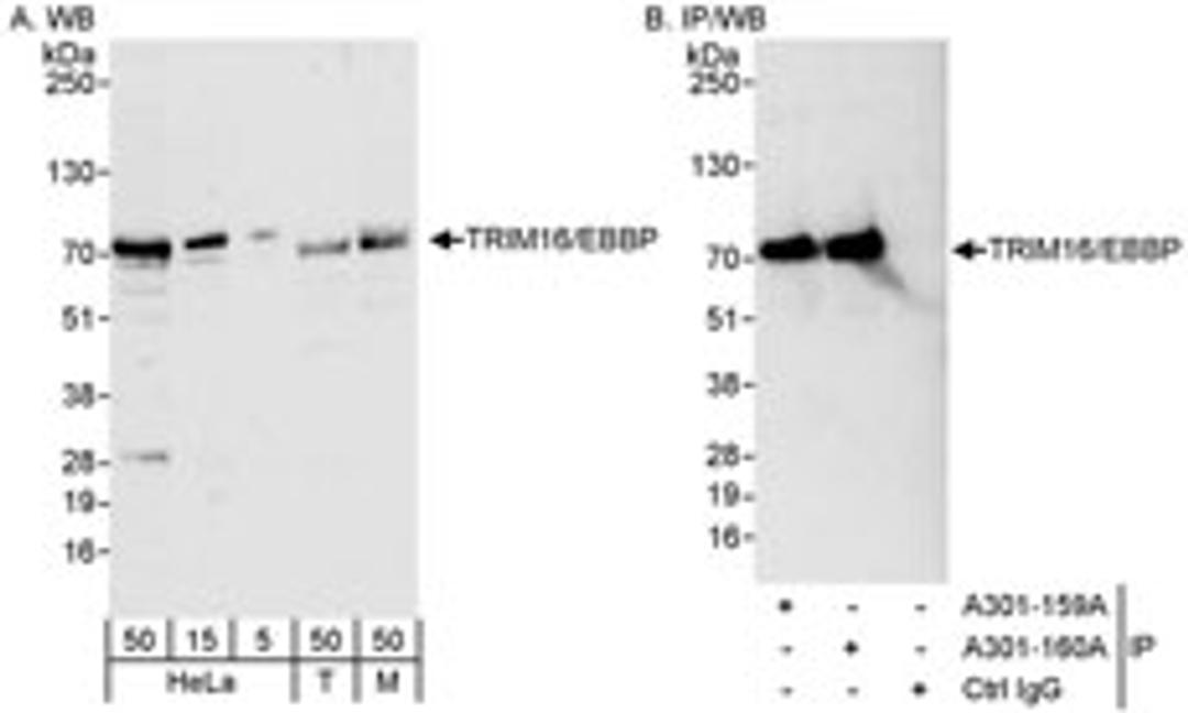 Detection of human and mouse TRIM16/EBBP by western blot (h&m) and immunoprecipitation (h).