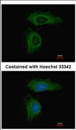 Immunocytochemistry/Immunofluorescence: PPP2R1A Antibody [NBP2-19907] - Immunofluorescence analysis of methanol-fixed HeLa, using antibody at 1:500 dilution.