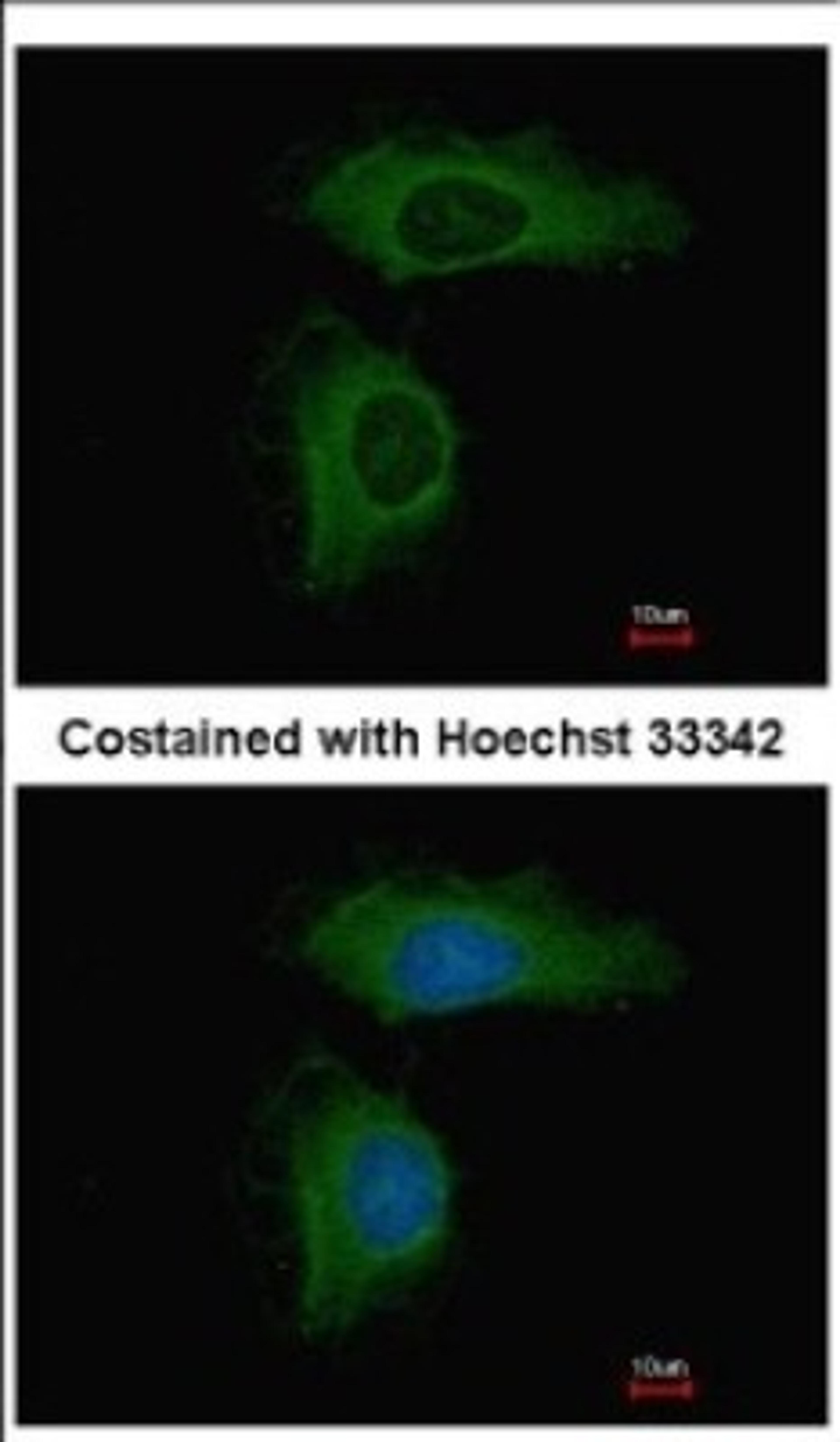 Immunocytochemistry/Immunofluorescence: PPP2R1A Antibody [NBP2-19907] - Immunofluorescence analysis of methanol-fixed HeLa, using antibody at 1:500 dilution.