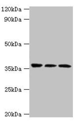 Western blot. All lanes: SLAMF7 antibody at 3µg/ml. Lane 1: Jurkat whole cell lysate. Lane 2: K562 whole cell lysate. Lane 3: Mouse spleen tissue. Secondary. Goat polyclonal to rabbit IgG at 1/10000 dilution. Predicted band size: 38, 26, 18, 33, 23, 22 kDa. Observed band size: 38 kDa