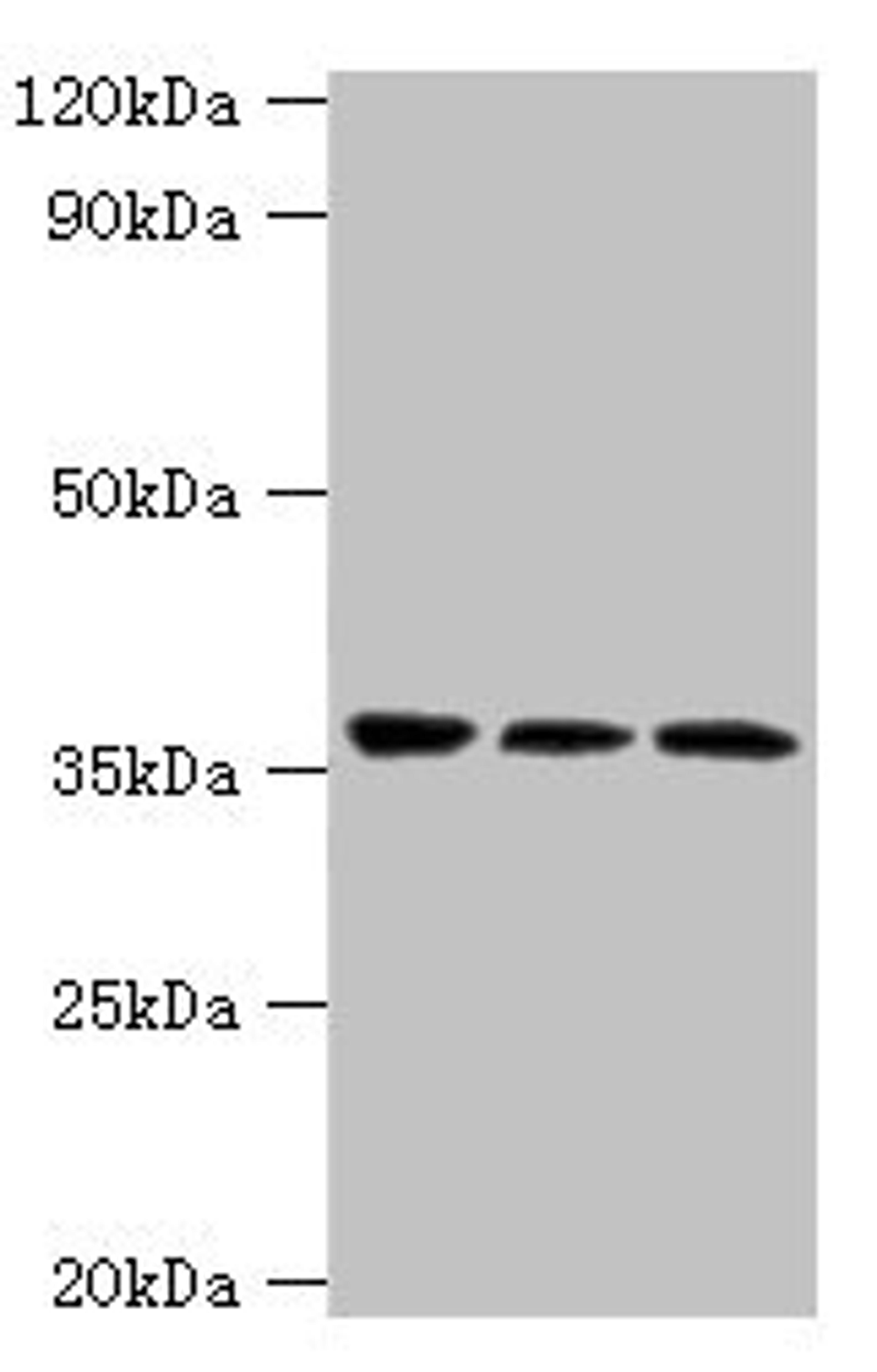 Western blot. All lanes: SLAMF7 antibody at 3µg/ml. Lane 1: Jurkat whole cell lysate. Lane 2: K562 whole cell lysate. Lane 3: Mouse spleen tissue. Secondary. Goat polyclonal to rabbit IgG at 1/10000 dilution. Predicted band size: 38, 26, 18, 33, 23, 22 kDa. Observed band size: 38 kDa