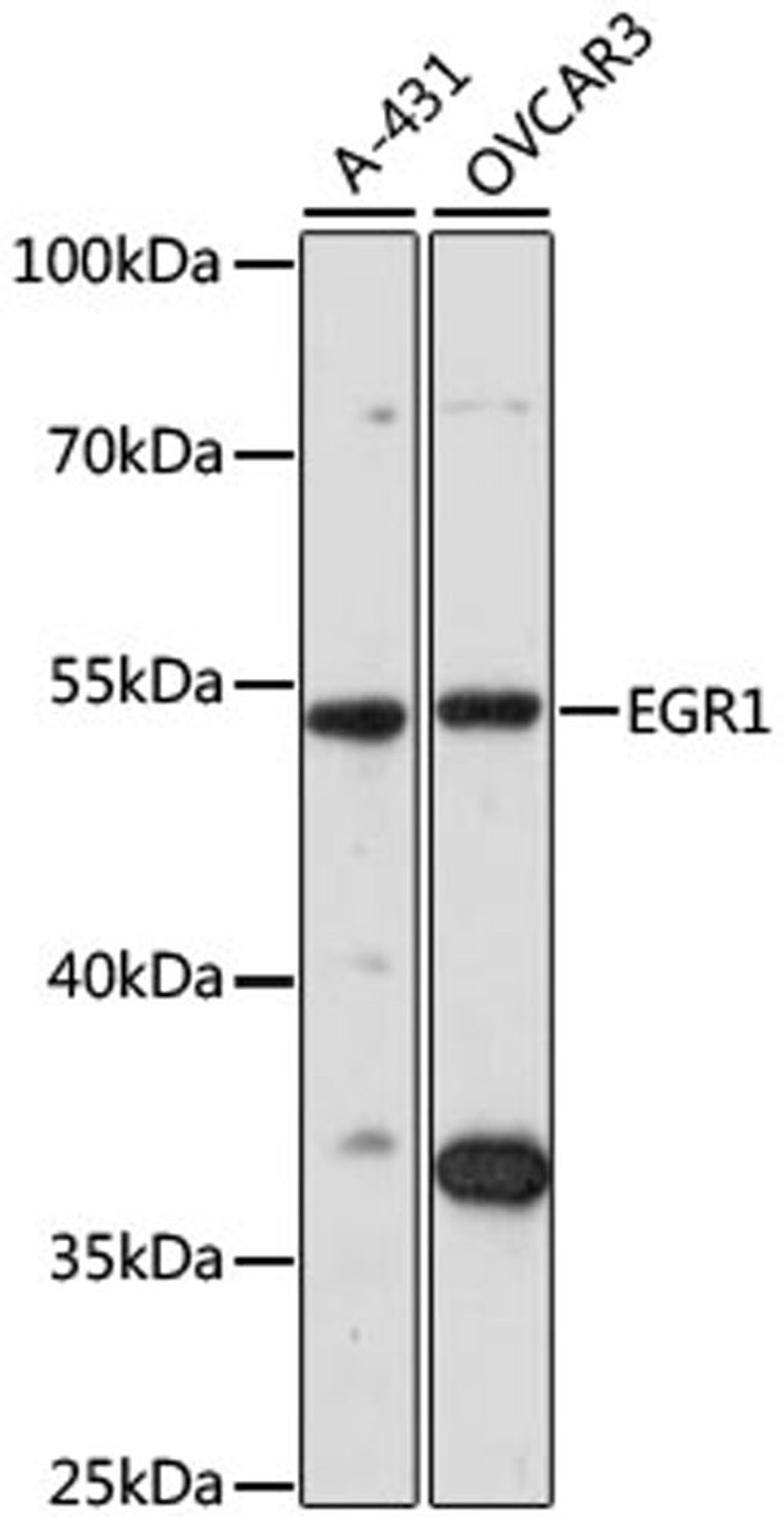 Western blot - EGR1 antibody (A7266)