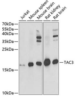 Western blot - TAC3 antibody (A6312)