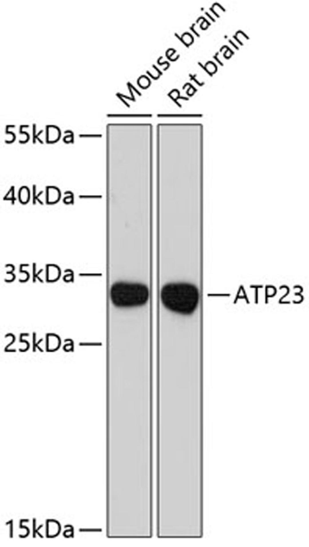 Western blot - ATP23 antibody (A12885)