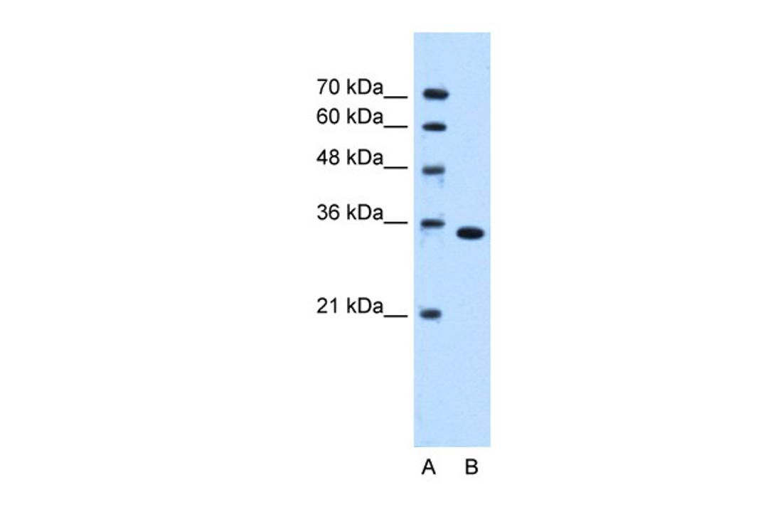 Antibody used in WB on Human Jurkat cells at 0.2-1 ug/ml.