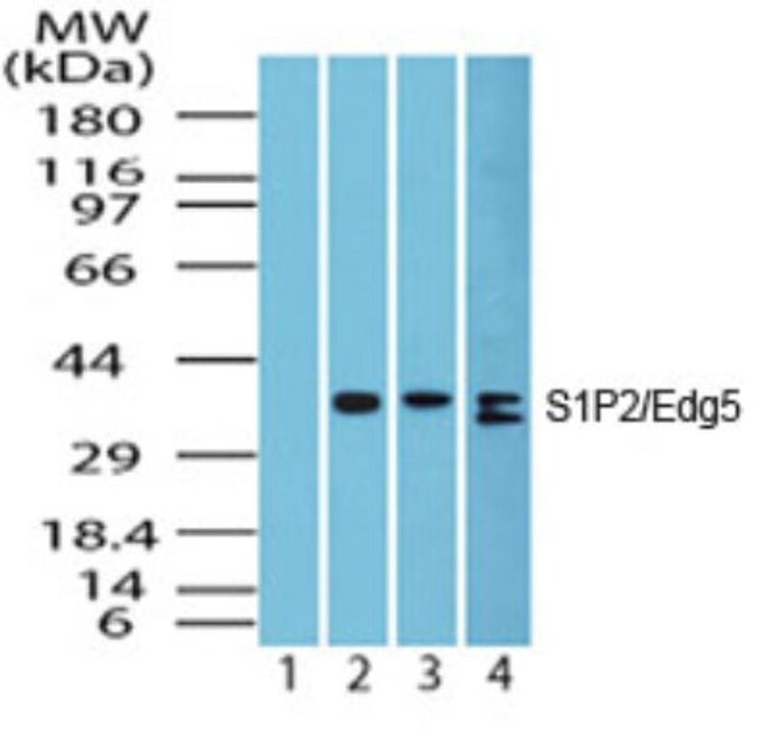 Western Blot: S1PR2 Antibody [NBP2-26691] - Analysis of S1P2/Edg5 in heart lysate; Lane 1 shows pre-immune sera; Lanes 2, 3 and 4 show this antibody tested on human heart (1 ug/ml), mouse heart (1 ug/ml) and rat heart (2 ug/ml) lysate, respectively.