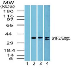 Western Blot: S1PR2 Antibody [NBP2-26691] - Analysis of S1P2/Edg5 in heart lysate; Lane 1 shows pre-immune sera; Lanes 2, 3 and 4 show this antibody tested on human heart (1 ug/ml), mouse heart (1 ug/ml) and rat heart (2 ug/ml) lysate, respectively.