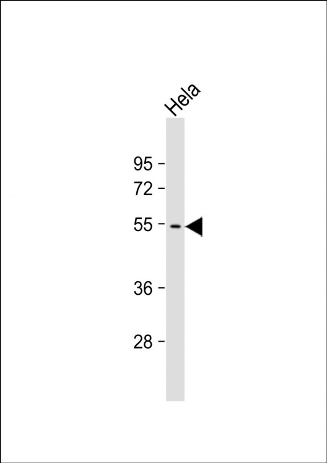 Western Blot at 1:1000 dilution + Hela whole cell lysate Lysates/proteins at 20 ug per lane.