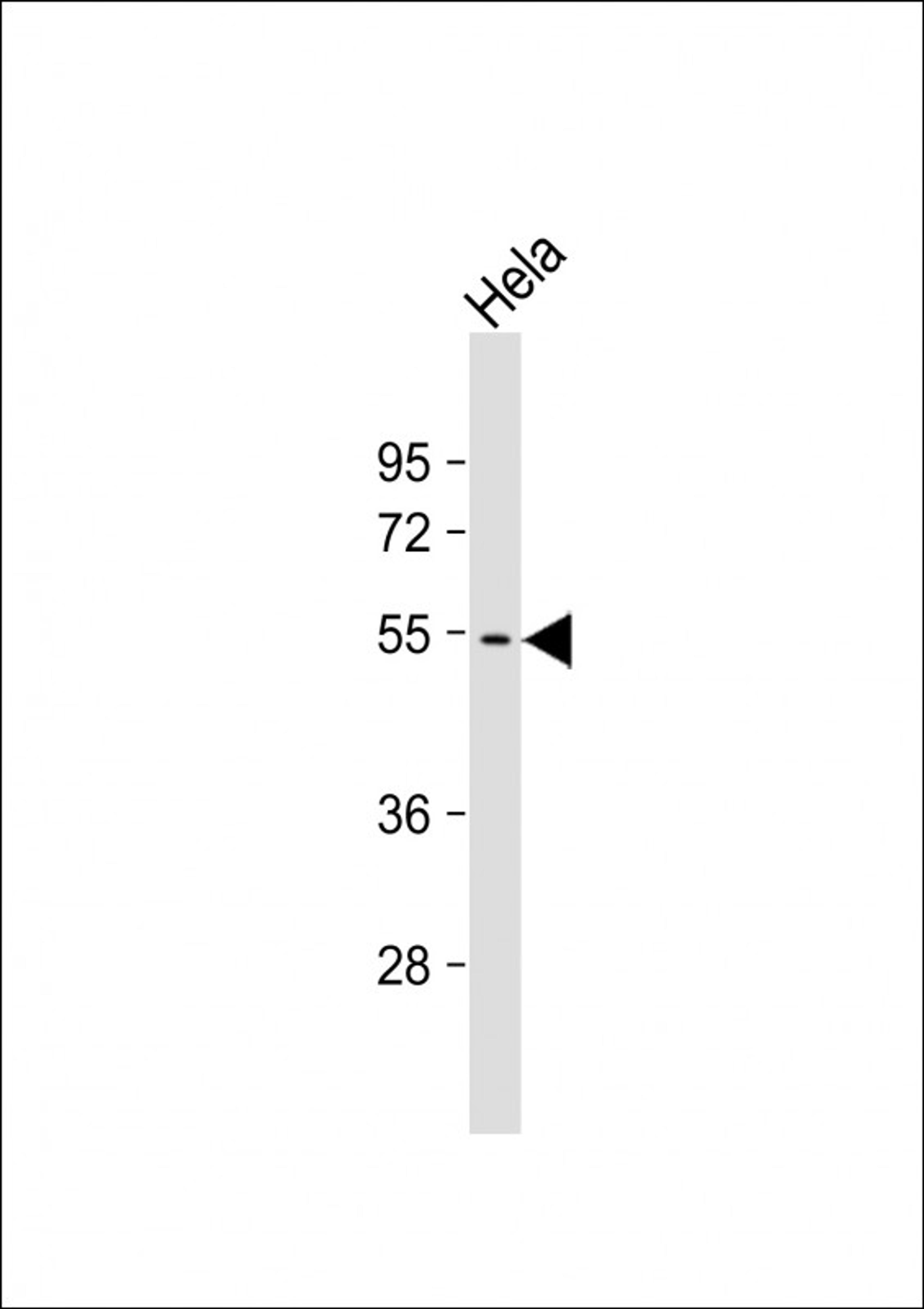 Western Blot at 1:1000 dilution + Hela whole cell lysate Lysates/proteins at 20 ug per lane.