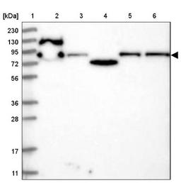 Western Blot: KLRAQ1 Antibody [NBP1-86582] - Lane 1: Marker [kDa] 230, 130, 95, 72, 56, 36, 28, 17, 11<br/>Lane 2: Human cell line RT-4<br/>Lane 3: Human cell line U-251MG sp<br/>Lane 4: Human plasma (IgG/HSA depleted)<br/>Lane 5: Human liver tissue<br/>Lane 6: Human tonsil tissue