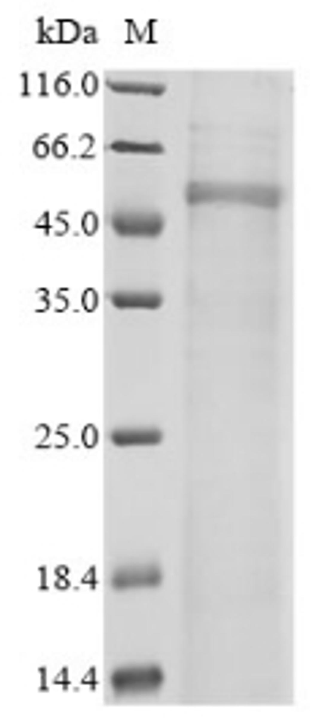 (Tris-Glycine gel) Discontinuous SDS-PAGE (reduced) with 5% enrichment gel and 15% separation gel.