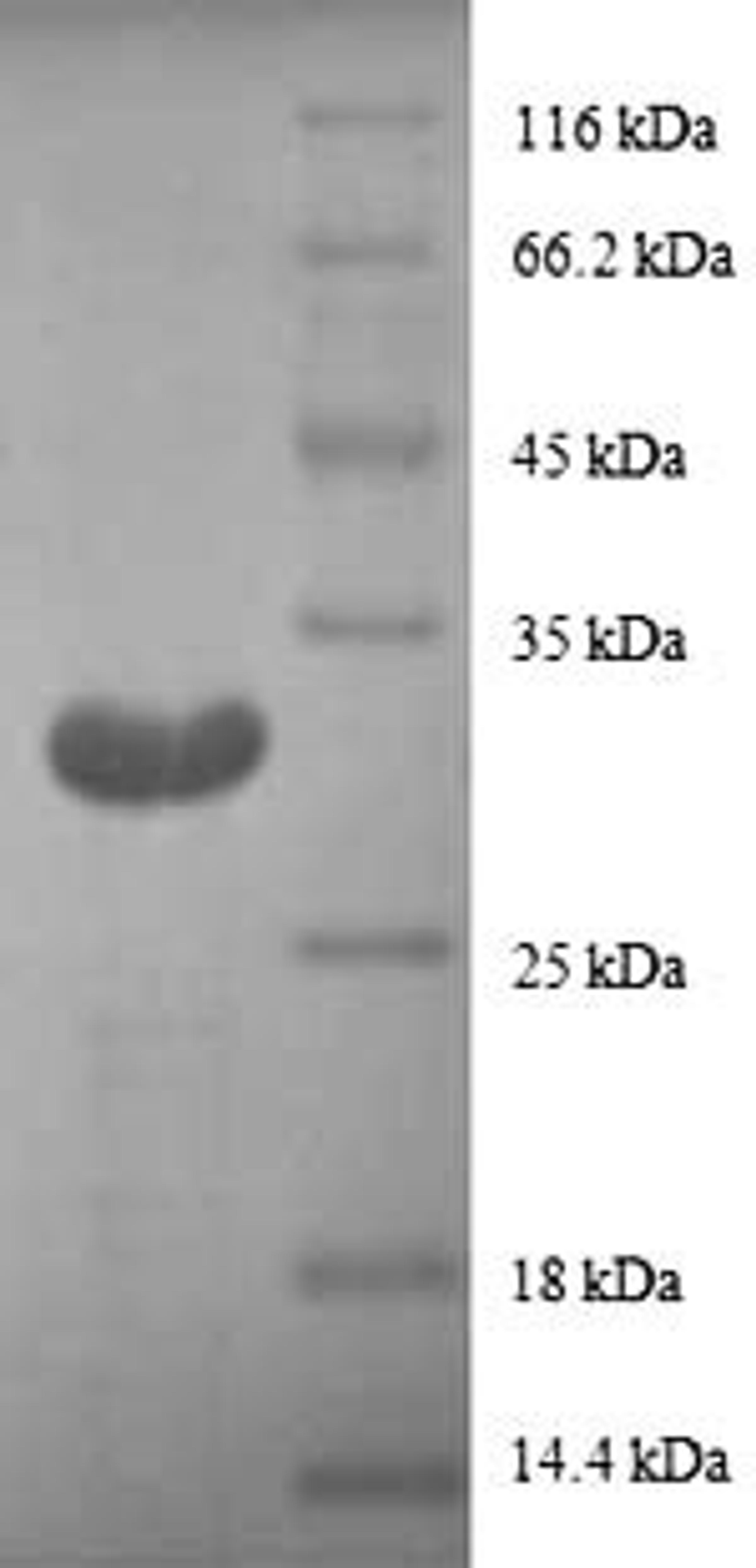 (Tris-Glycine gel) Discontinuous SDS-PAGE (reduced) with 5% enrichment gel and 15% separation gel.