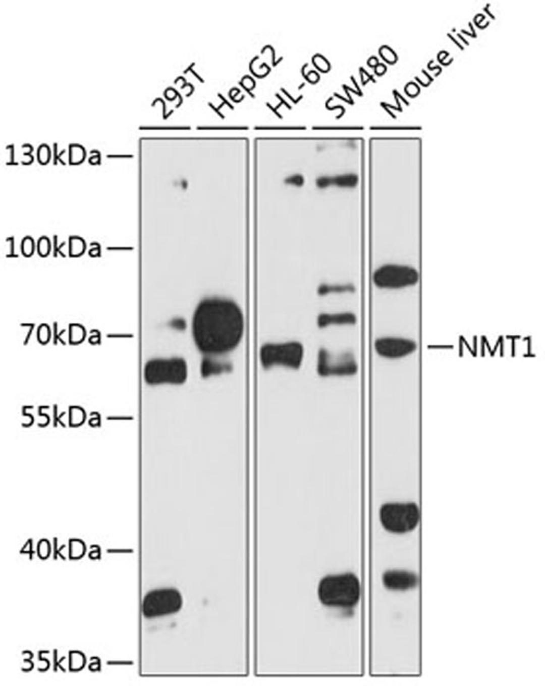 Western blot - NMT1 antibody (A8724)