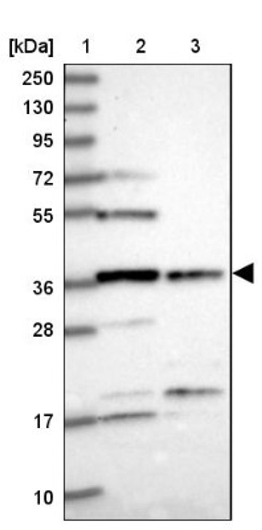 Western Blot: FAM118B Antibody [NBP1-93959] - Lane 1: Marker [kDa] 250, 130, 95, 72, 55, 36, 28, 17, 10<br/>Lane 2: Human cell line RT-4<br/>Lane 3: Human cell line U-251MG sp