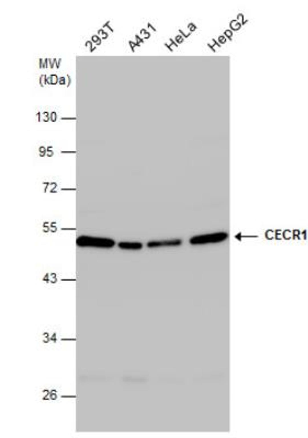 Western Blot: Adenosine Deaminase 2/CECR1 Antibody [NBP2-15855] - Various whole cell extracts (30 ug) were separated by 10% SDS-PAGE, and the membrane was blotted with CECR1 antibody diluted at 1:1000.