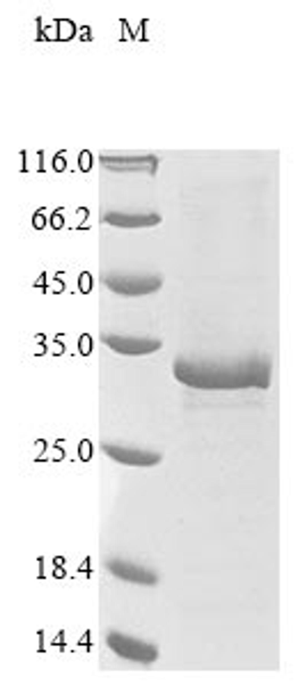 (Tris-Glycine gel) Discontinuous SDS-PAGE (reduced) with 5% enrichment gel and 15% separation gel.