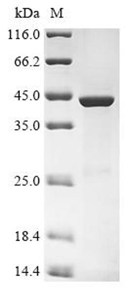 (Tris-Glycine gel) Discontinuous SDS-PAGE (reduced) with 5% enrichment gel and 15% separation gel.