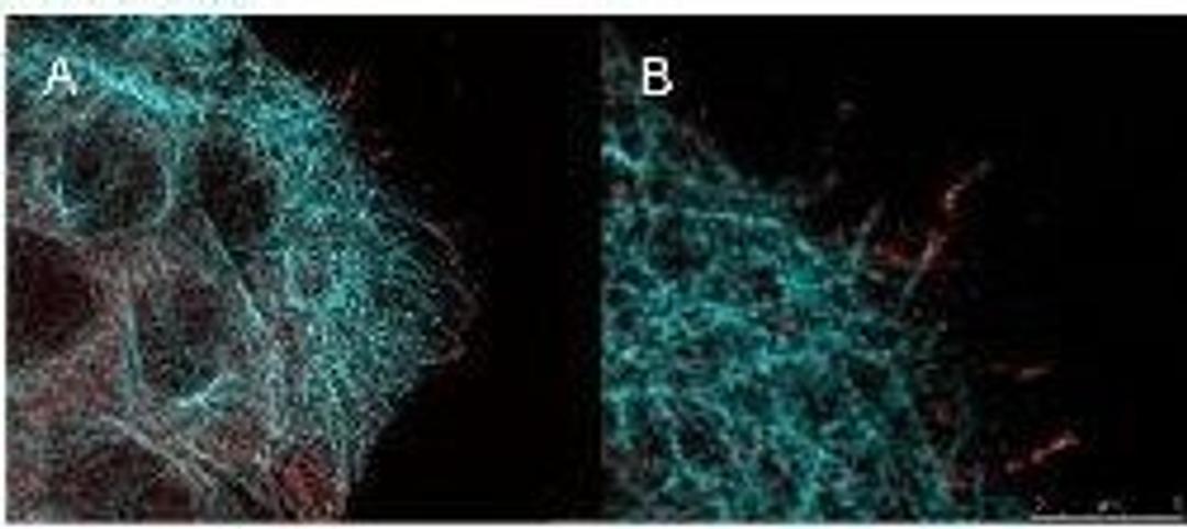 Immunofluorescence analysis of A431 cells using Akt (phospho-S473) antibody