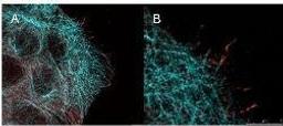 Immunofluorescence analysis of A431 cells using Akt (phospho-S473) antibody