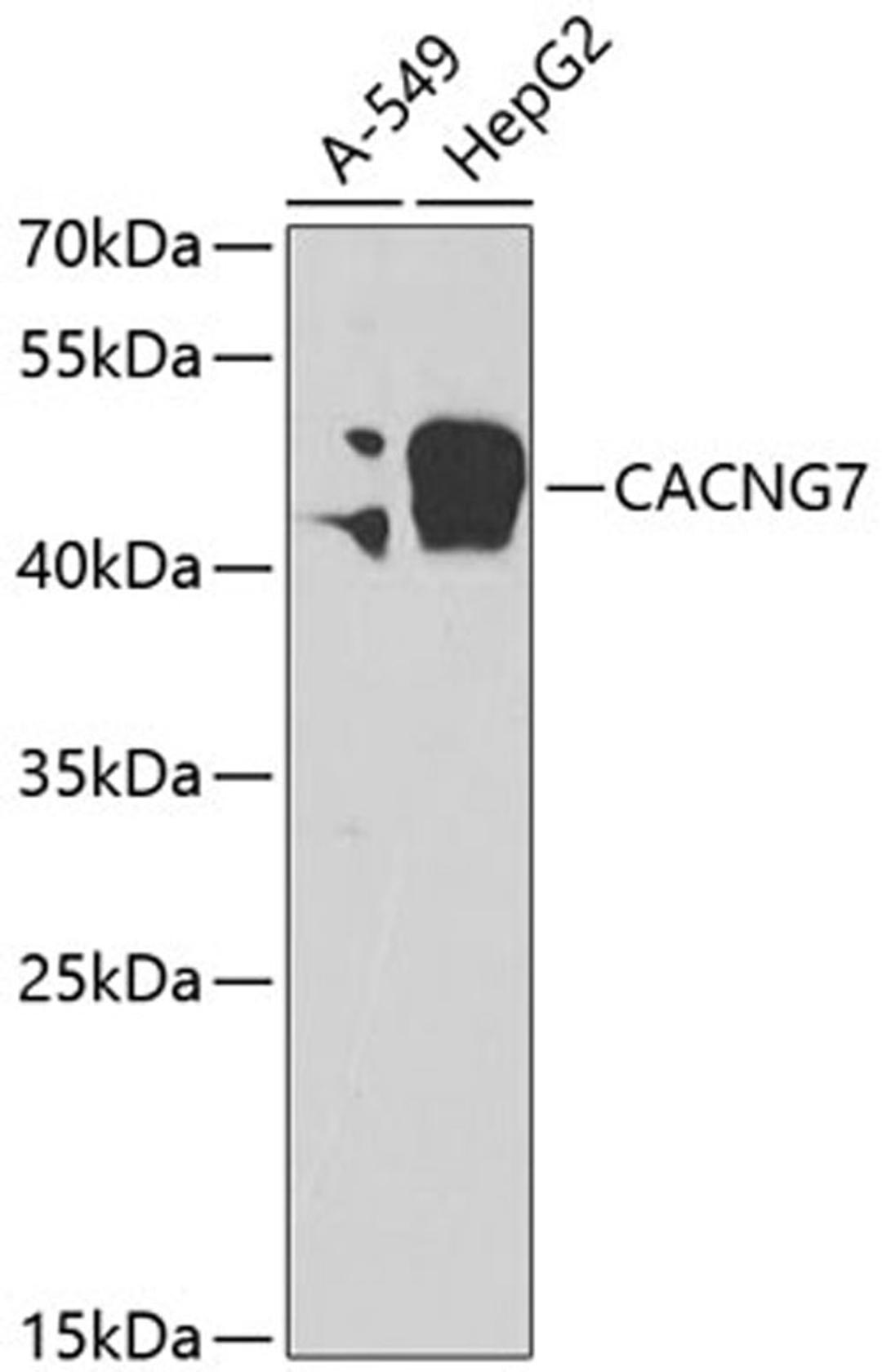 Western blot - CACNG7 antibody (A7989)