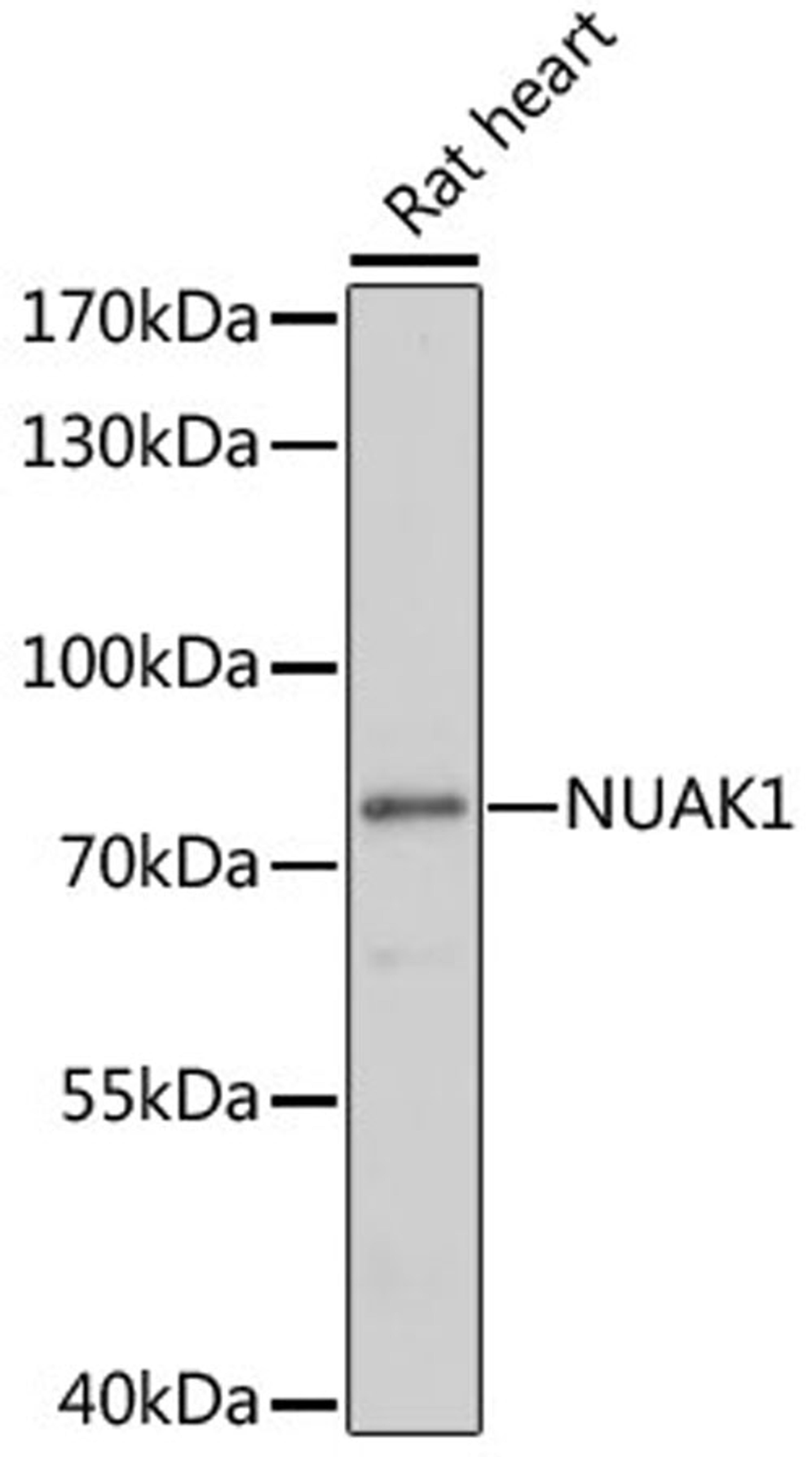 Western blot - NUAK1 antibody (A17333)