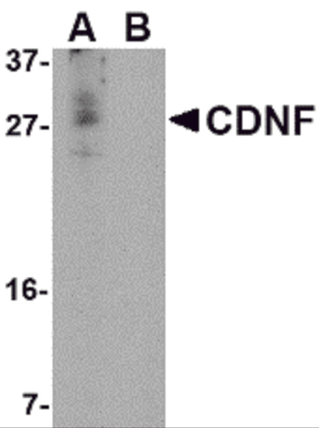 Western blot analysis of CDNF in A-20 cell lysate in (A) the absence and (B) the presence of blocking peptide with CDNF antibody at 1 μg/mL.