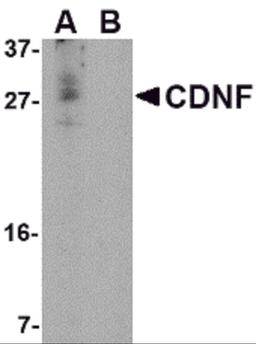 Western blot analysis of CDNF in A-20 cell lysate in (A) the absence and (B) the presence of blocking peptide with CDNF antibody at 1 μg/mL.