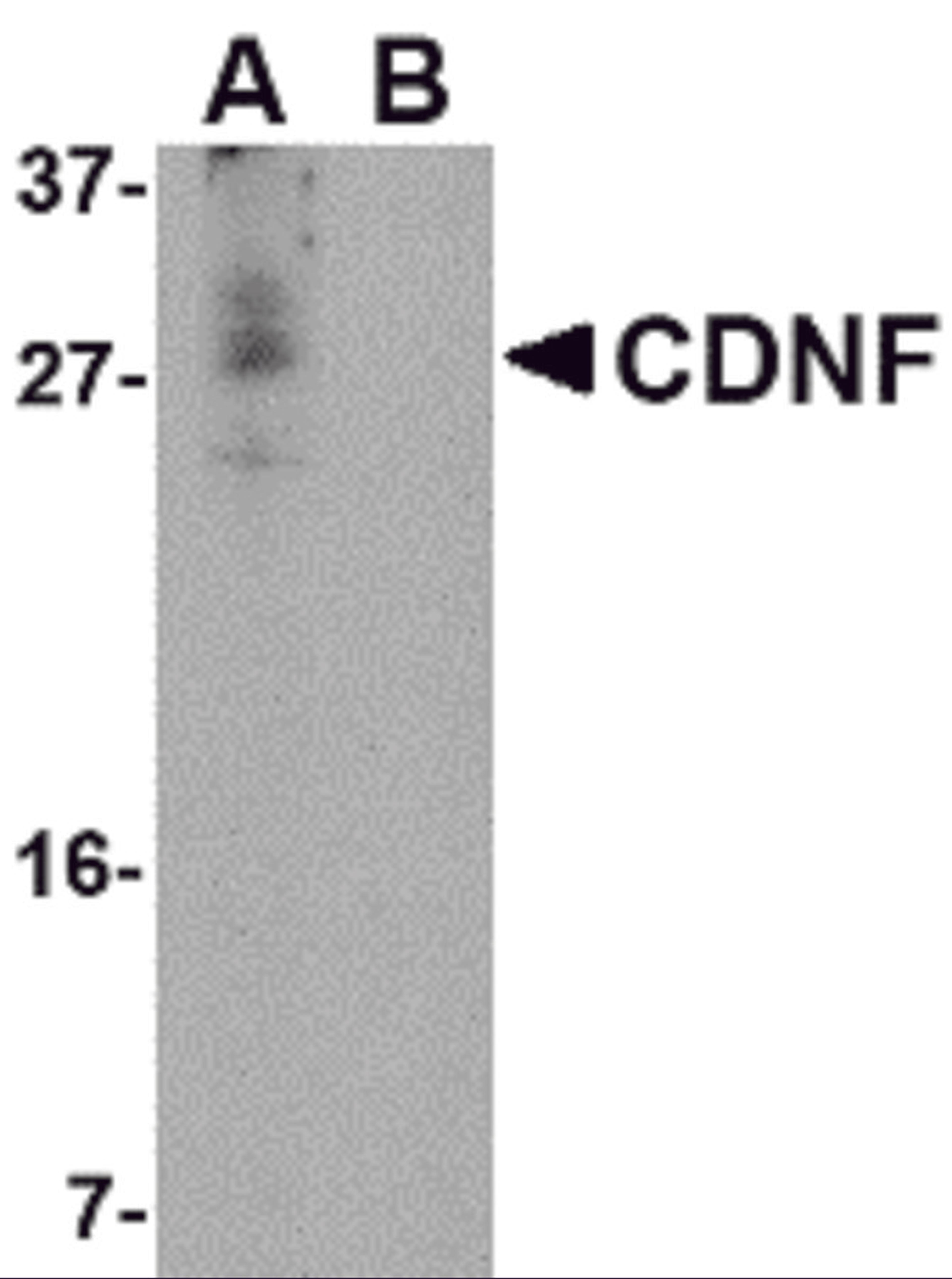 Western blot analysis of CDNF in A-20 cell lysate in (A) the absence and (B) the presence of blocking peptide with CDNF antibody at 1 μg/mL.