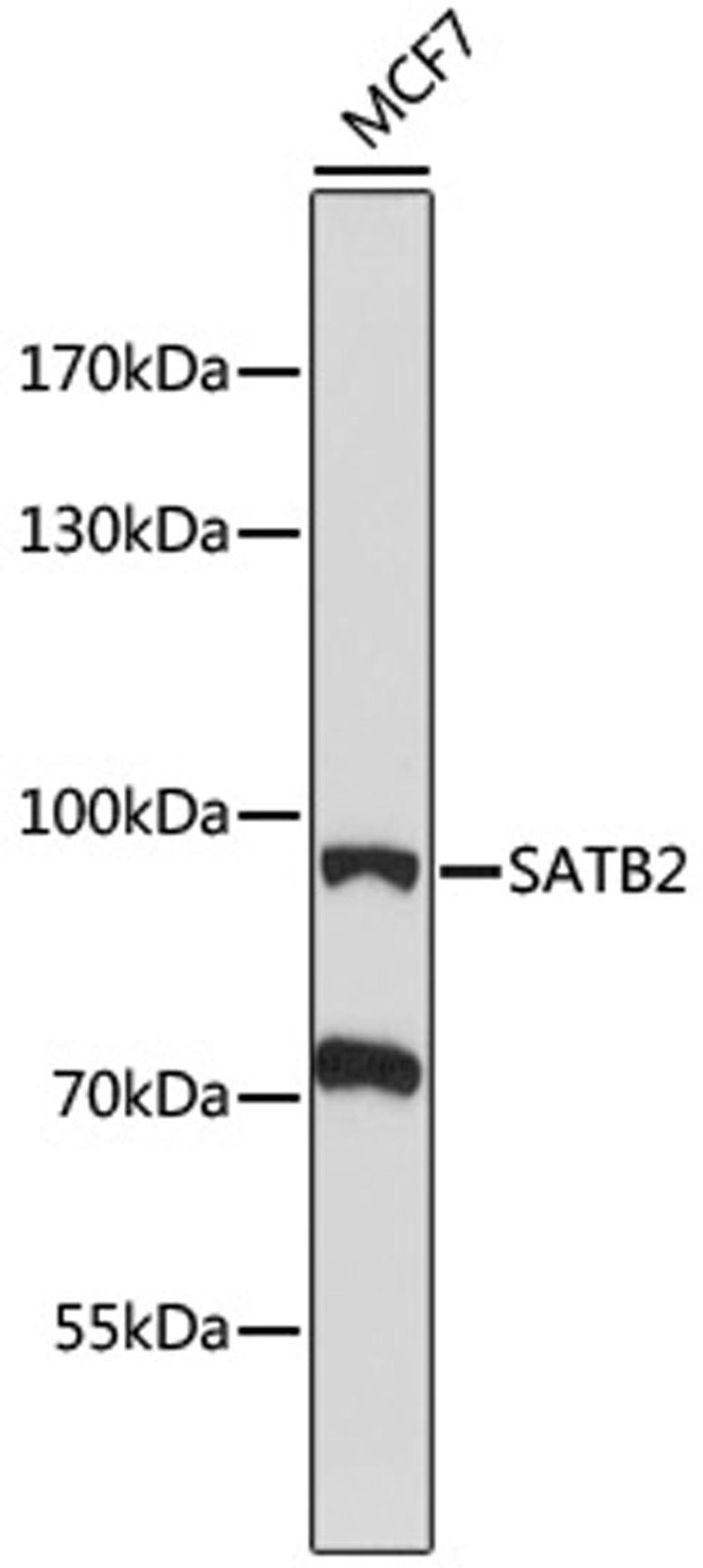 Western blot - SATB2 antibody (A16721)