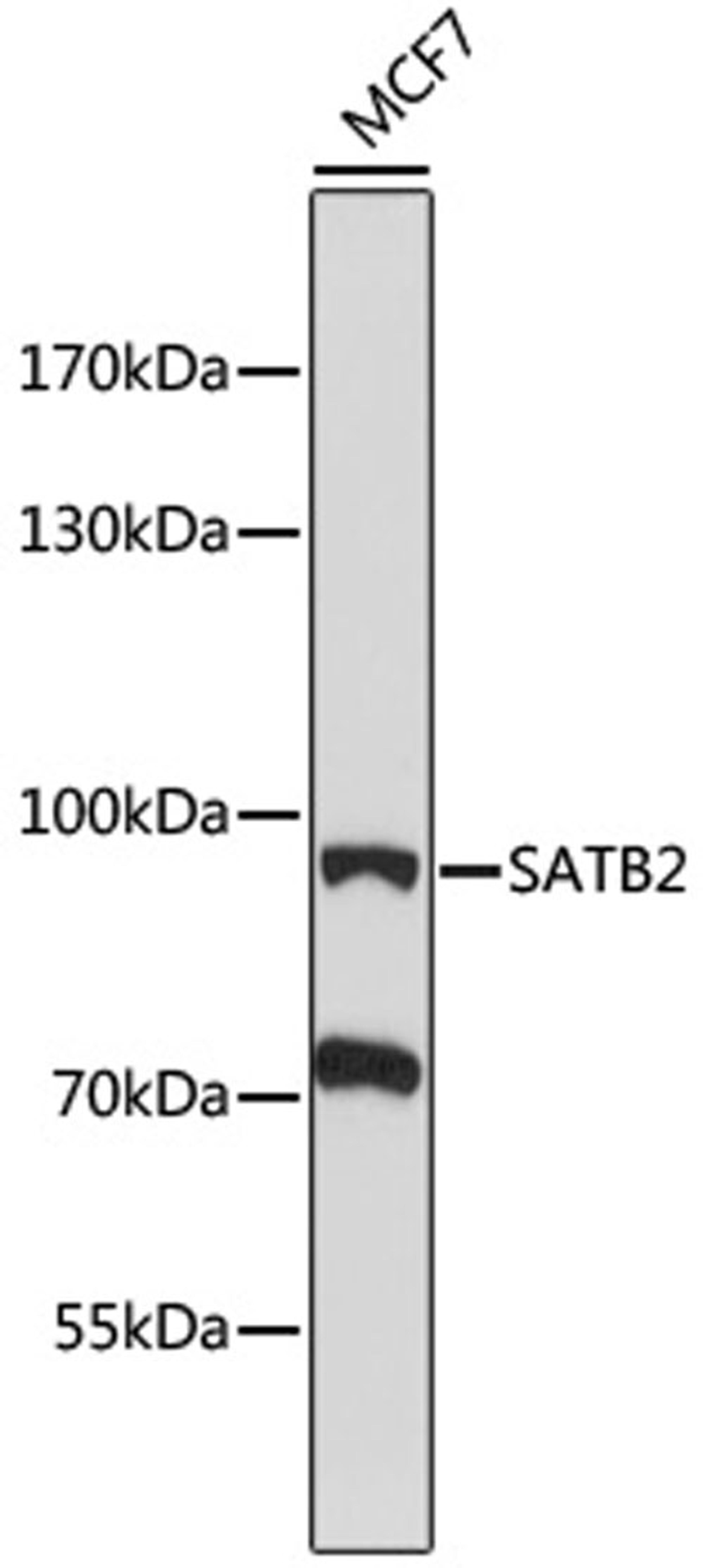 Western blot - SATB2 antibody (A16721)