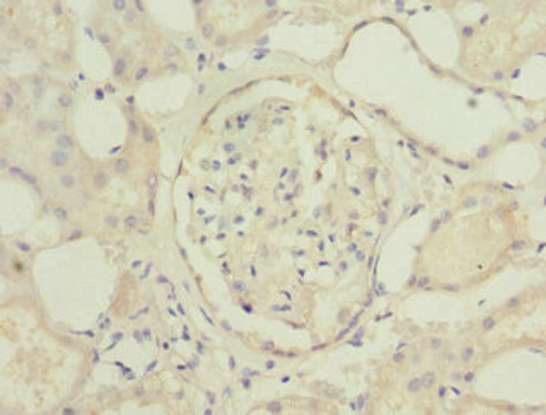 Immunohistochemistry of paraffin-embedded human kidney tissue using CSB-PA740850ESR2HU at dilution of 1:100