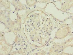 Immunohistochemistry of paraffin-embedded human kidney tissue using CSB-PA740850ESR2HU at dilution of 1:100