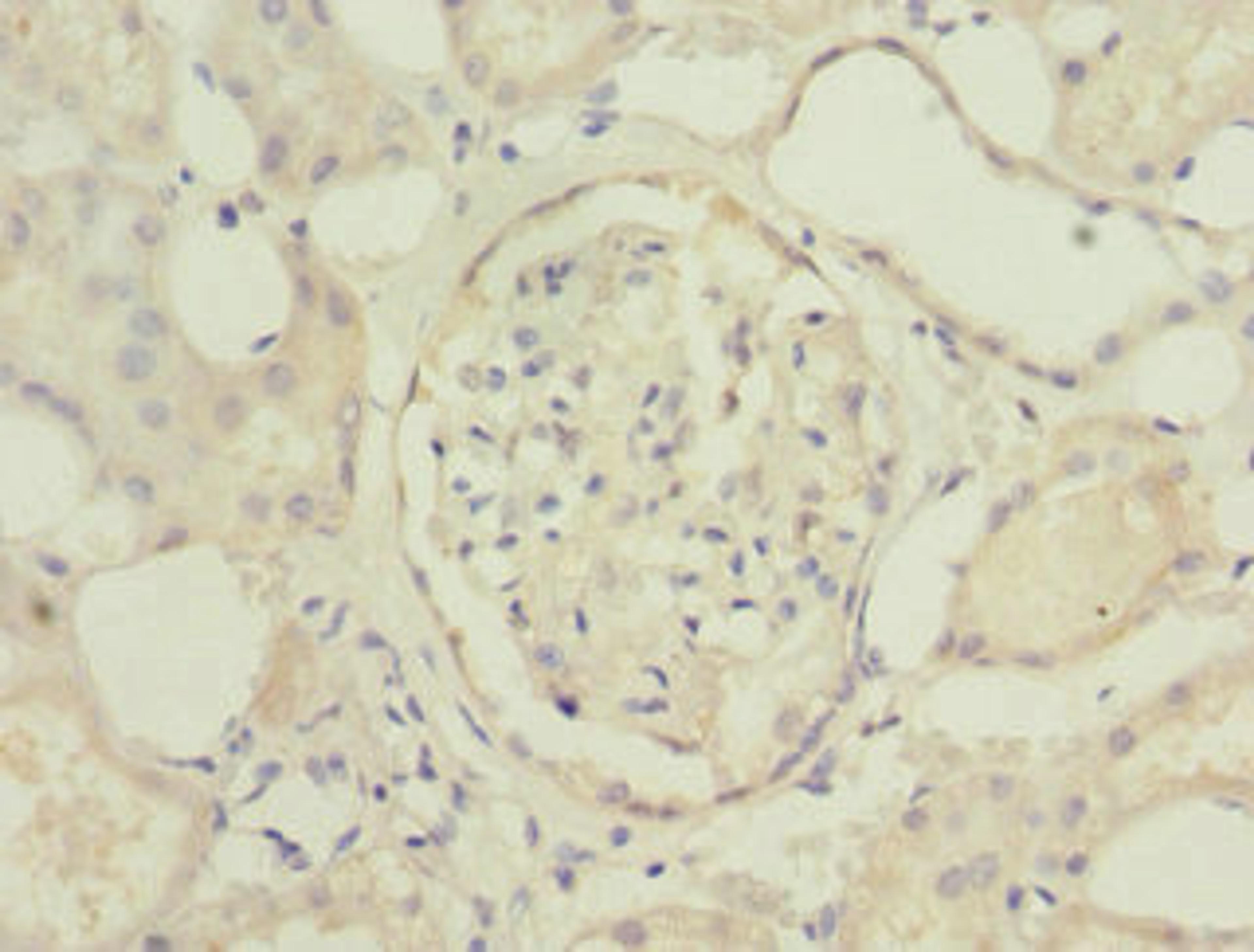 Immunohistochemistry of paraffin-embedded human kidney tissue using CSB-PA740850ESR2HU at dilution of 1:100