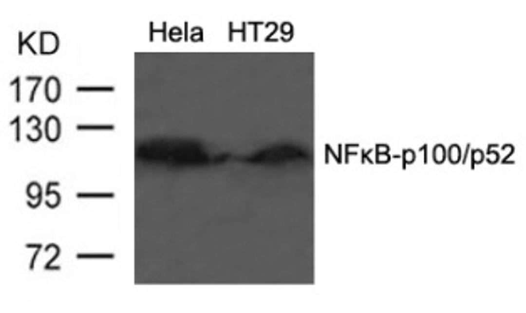 Western blot analysis of lysed extracts from HT29 cells using NF&#954;B-p100/p52 (Ab-866).