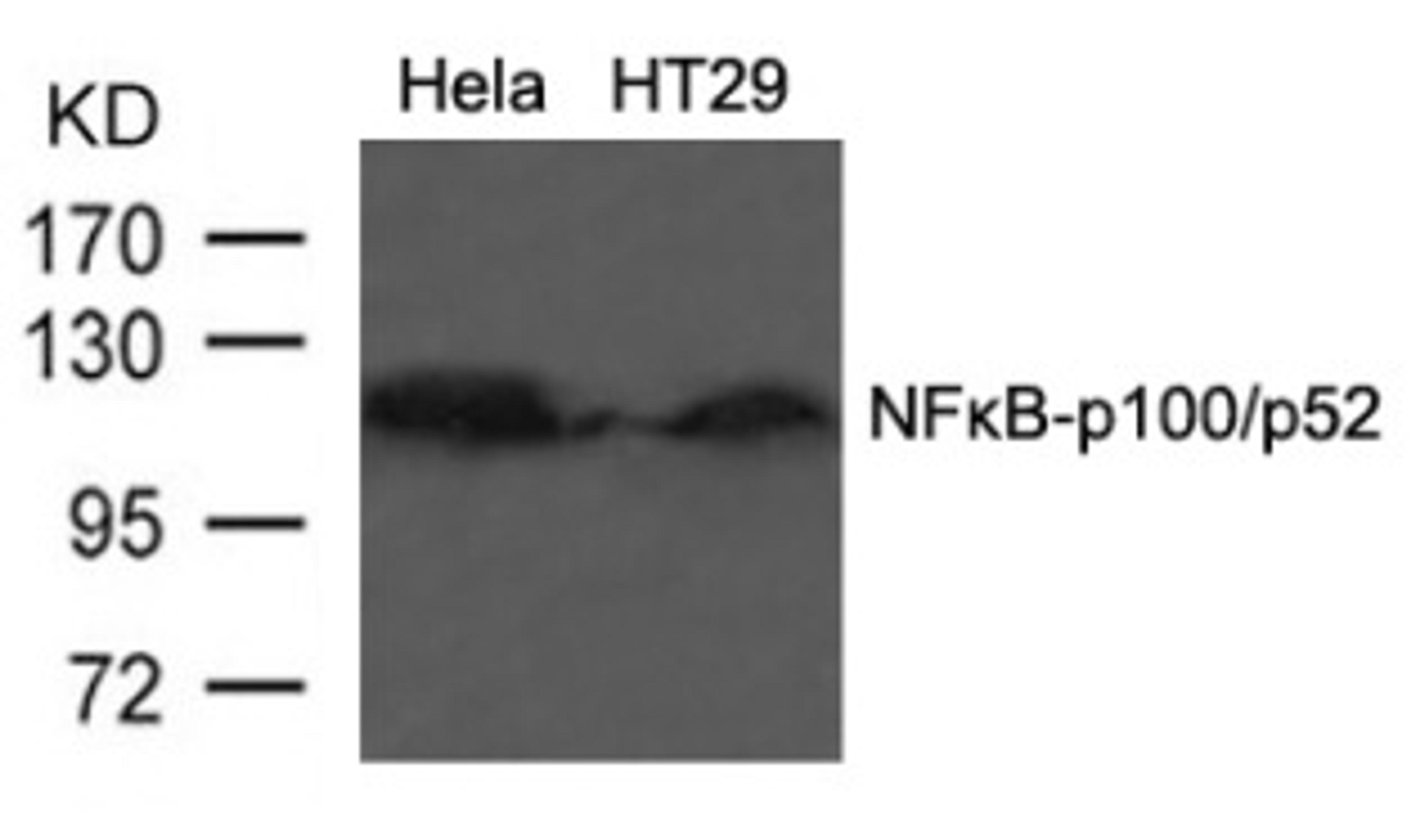 Western blot analysis of lysed extracts from HT29 cells using NFκB-p100/p52 (Ab-866).