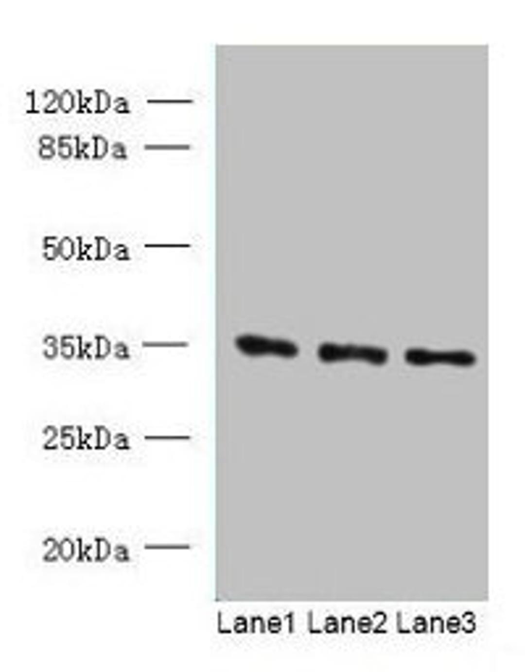 Western blot. All lanes: C15orf41 antibody at 1.5ug/ml. Lane 1: K562 whole cell lysate. Lane 2: HepG2 whole cell lysate. Lane 3: U251 whole cell lysate. Secondary. Goat polyclonal to rabbit IgG at 1/10000 dilution. Predicted band size: 33, 22 kDa. Observed band size: 33 kDa. 