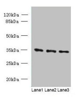 Western blot. All lanes: C15orf41 antibody at 1.5ug/ml. Lane 1: K562 whole cell lysate. Lane 2: HepG2 whole cell lysate. Lane 3: U251 whole cell lysate. Secondary. Goat polyclonal to rabbit IgG at 1/10000 dilution. Predicted band size: 33, 22 kDa. Observed band size: 33 kDa. 