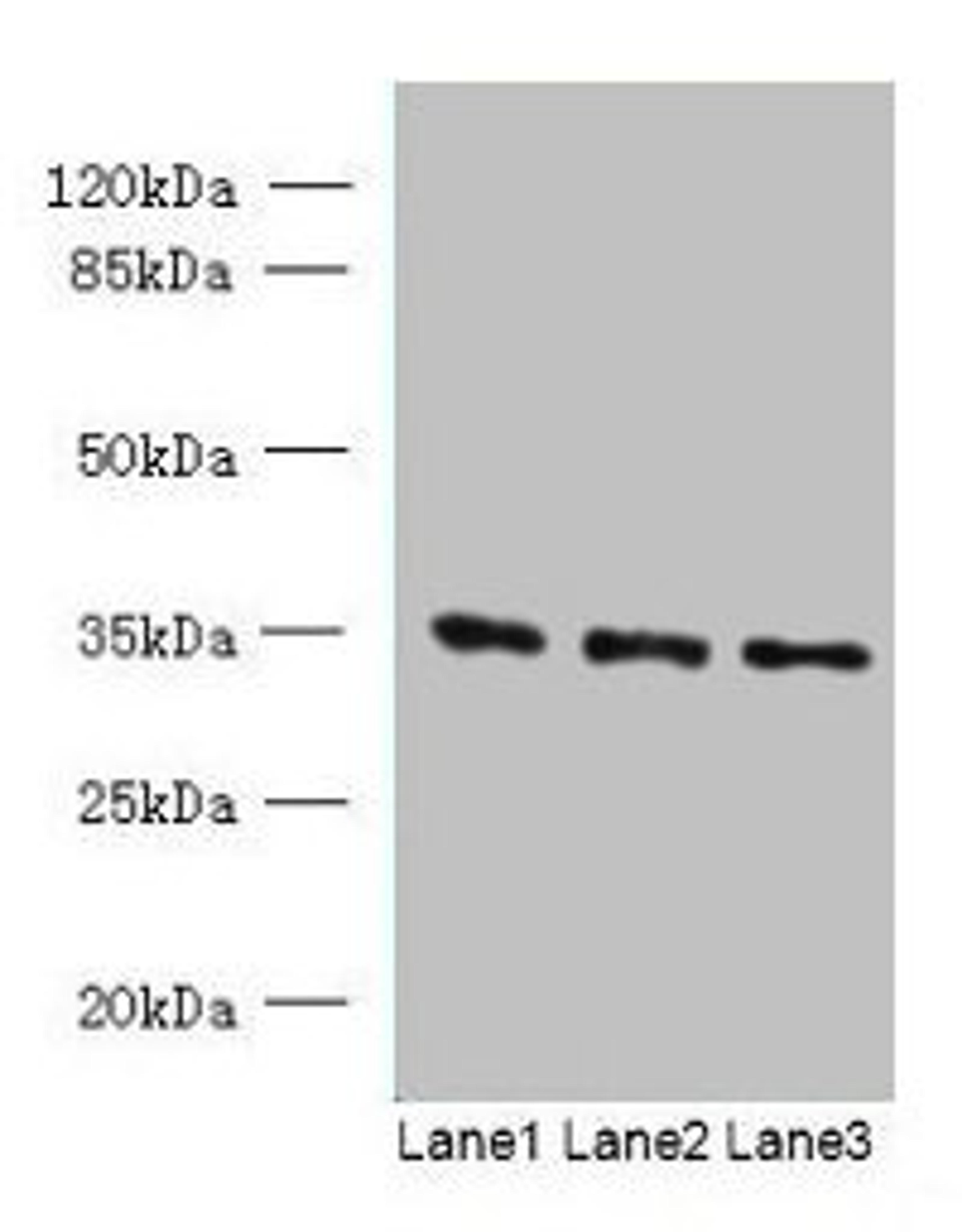 Western blot. All lanes: C15orf41 antibody at 1.5ug/ml. Lane 1: K562 whole cell lysate. Lane 2: HepG2 whole cell lysate. Lane 3: U251 whole cell lysate. Secondary. Goat polyclonal to rabbit IgG at 1/10000 dilution. Predicted band size: 33, 22 kDa. Observed band size: 33 kDa. 